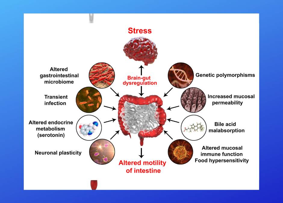 Gut Directed Hypnotherapy for IBS